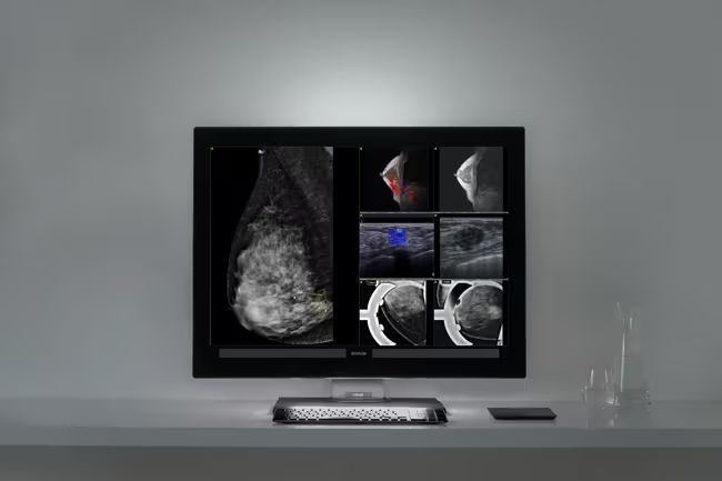 Breast imaging displays